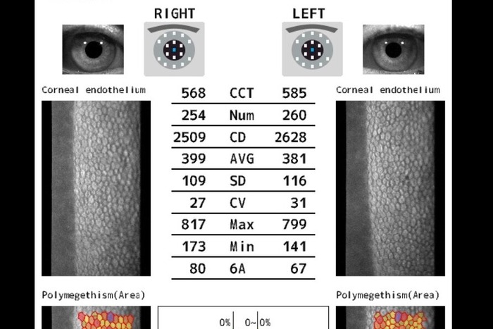 Biomicroscopia Especular